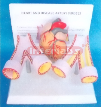 HUMAN HEART AND DISEASE ARTERY MODELS